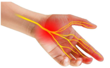 Điều trị tê bì tay chân với Đông y