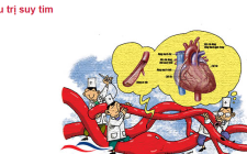 Điều trị suy tim theo đông y