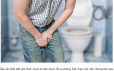Bài thuốc đông y  chữa viêm đường tiết niệu 