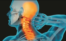 YHCT điều trị tho&aacute;i h&oacute;a đốt sống cổ