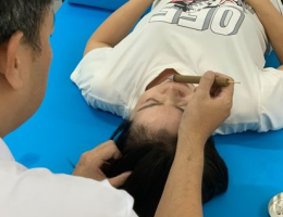 Cứu ngải điều trị mất ngủ