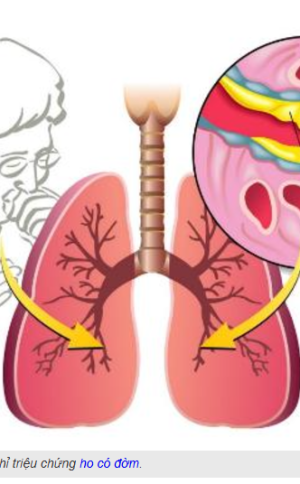 4 b&agrave;i thuốc Đ&ocirc;ng y trị ho hiệu quả
