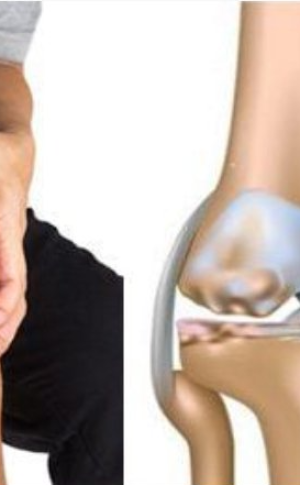 Điều trị tho&aacute;i h&oacute;a khớp gối bằng Đ&ocirc;ng y