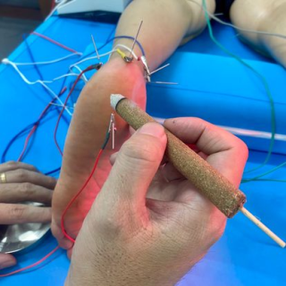 Điều trị đau gót chân