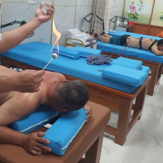 giác hơi bằng lửa