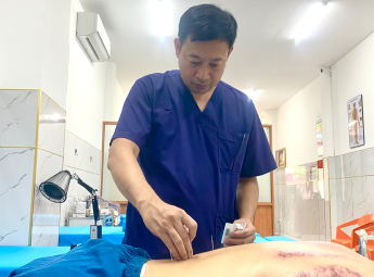 Dịch vụ châm cứu tại nhà