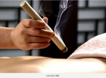 Đốt cứu điều trị chứng nuy