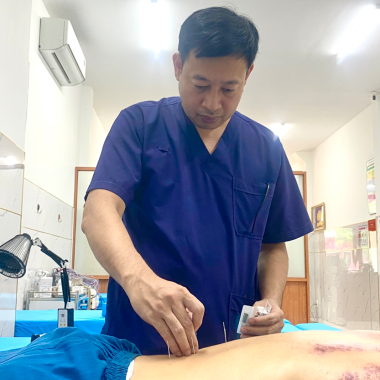 Dịch vụ ch&acirc;m cứu tại nh&agrave;