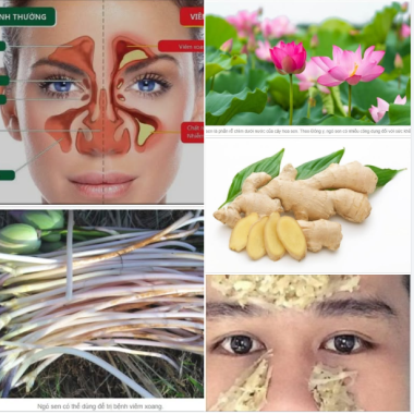 Mẹo trị vi&ecirc;m xoang bằng ng&oacute; sen cực đơn giản v&agrave; hiệu quả