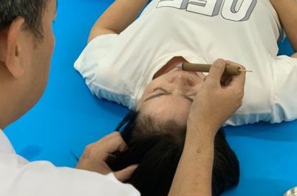Cứu ngải điều trị mất ngủ